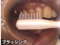 ブラッシング